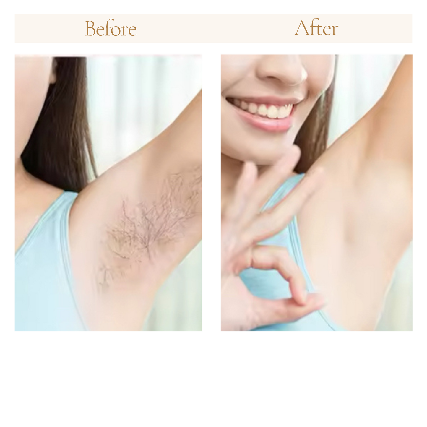 IPL Laser Hair Removal